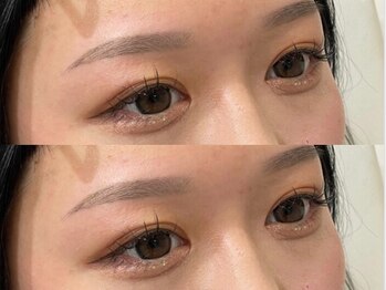 アイズ 天神大名店(eye's)の写真/“お顔のトーン・肌艶アップ”痛みが少ないＷＡＸ脱毛で汚れや古い角質をしっかり落としましょう◎