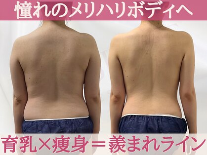 キャンベル(CANBELLE)の写真