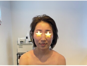 クラルスシンメトリーサロン 高槻店(Clarus Symmetry Salon)/スッキリフェイス♪