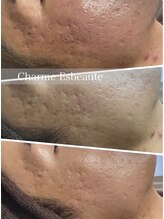 シャルム エスボーテ(charme Esbeaute)/対処療法ではなく根本改善