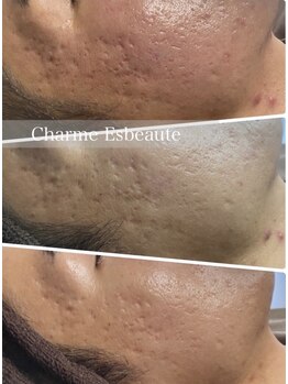シャルム エスボーテ(charme Esbeaute)/対処療法ではなく根本改善