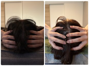 アロラヴィ(AroRavi)/頭蓋骨矯正