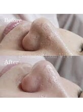 ウェルビーイング(well-being)/毛穴ごっそり洗浄メソッド