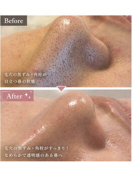 ベベ(bebe)/1度でこの変化