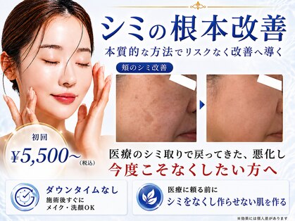シャルナ(charna)の写真