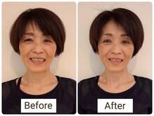 あんじゅみにょん80の雰囲気（老廃物が流れて本来の二重が戻ってきます。）