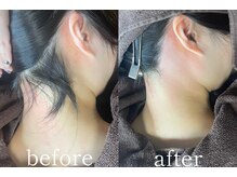 ムート(Mut.)/うなじワックス＋光脱毛。