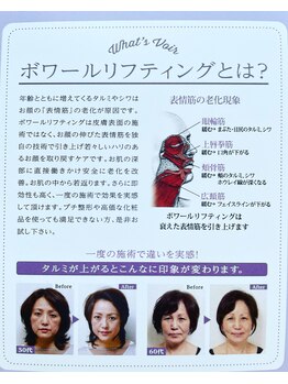 リアンシャンテ(Re enchanter)/ボワールリフティングとは？