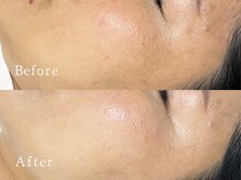 クリアー(CLEAR.)/【Before＆After】