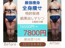 ダイエット サポート(DIET SUPPORT)