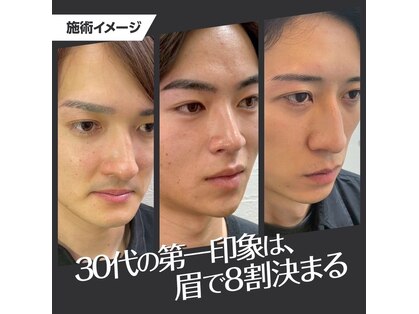 エルエス アイブロウ(L/S)の写真