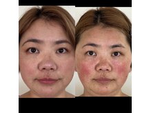 スキンかから始まるパーソナルメイクレッスン♪