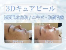 アザレア(Azalea)の雰囲気（【3Dキュアピーリング/毛穴/サーマジェン/マイクロウェーブ】）