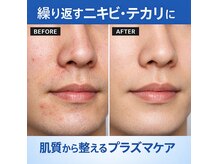 デジールの雰囲気（夏のメンズ肌管理で清潔感UP【メンズ毛穴ニキビプラズマケア】）