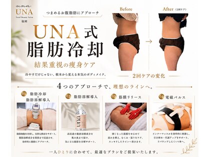 ウナ 福岡(UNA)の写真