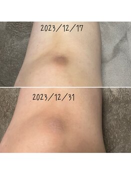 アルディート(Ardito)/ホワイトスノーピール