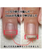 スマイルニコ(smile nico)/2ヶ月でできること