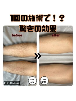 エヌ(N)/1回目から効果がわかる★