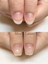 マリーロール 天王寺店(Marie Laure)/深爪改善/自爪育成/ネイルケア