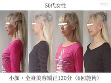 エクラ(eclat)/横顔が美しく小顔に。