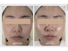 ナチュリー(Naturry)/水光肌を目指します。