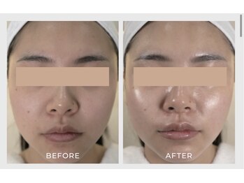 ナチュリー(Naturry)/水光肌を目指します。