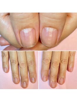 ココデネイル(cocode nail)/悩み:爪が割れやすい(50代前半)