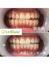 ルブラン 奈良店(Le Blanc)/フリーパススタート！