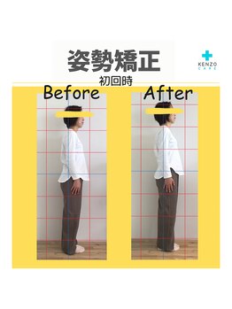 ケンゾー接骨院(KENZO接骨院)/腰痛改善
