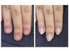 【深爪・噛み爪ケア】 初回カウンセリング＋クリアジェル　￥10,000