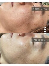 ザ プレザント 大倉山(the pleasant)/クリスティーナのビオフィート