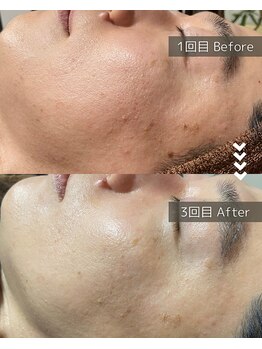 ザ プレザント 大倉山(the pleasant)/クリスティーナのビオフィート