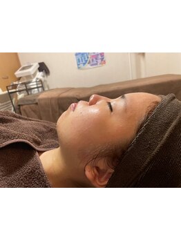 小顔になりたい