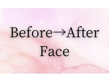 ビューティービューティー(beauty×beauty)/お客様結果