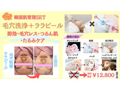 クローバー(clover)の写真