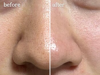 メルシア(merucia)/