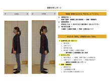 リファイン(Refine)/ゆがみを見える化　姿勢分析