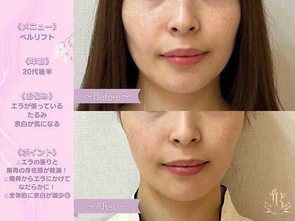 リリーベル 新宿歌舞伎町(Lily Belle)の写真