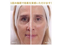 いえ ぷるの雰囲気（ &nbsp;&nbsp;&nbsp;ワンランク上のフェイシャル 小顔も美肌も叶える本格ケア）