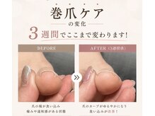 リリーベル(Lily Belle)の雰囲気（フットジェルもしながら巻き爪ケア出来ちゃいます！）