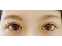 アビー(Abbey)/マツゲパーマラッシュリフト