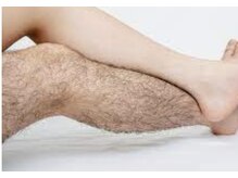 スター(Star)/メンズ足脱毛