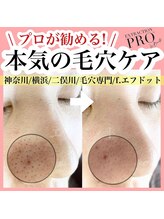 エフドット(f.)/