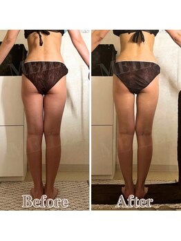 メイリー(MEILLI)/ハイパー&detoxスリムハンド60