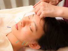 ミイ鍼灸院(mie鍼灸院)/美容鍼2