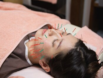 リゾート(Resort)/【肌質改善＊美容鍼】