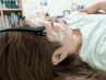 マイクロニードルで毛穴・たるみ・しみ・しわ・肌質改善！！効果絶大☆