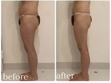 美人バスト 川崎店/【痩身・ダイエット】 川崎/脚☆