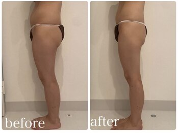 美人バスト 川崎店/【痩身・ダイエット】 川崎/脚☆