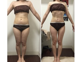 ヴェリティー(Verity)/ビフォーアフター